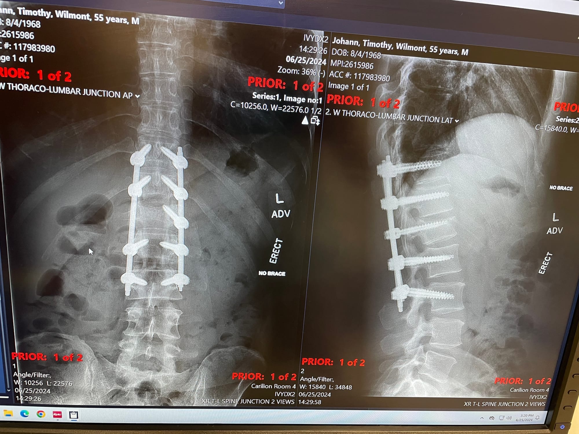 Before and after photos, and some other updates